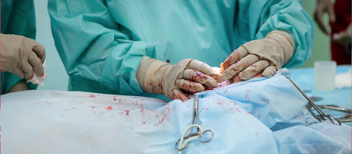 kidney operation